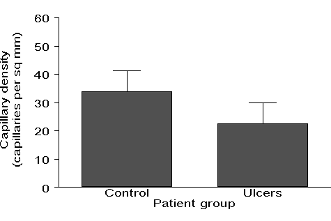 Bar chart with two bars and two error bars above them.